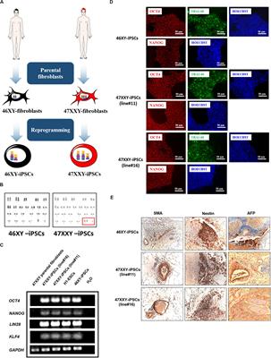 Modeling Klinefelter Syndrome Using Induced Pluripotent Stem Cells Reveals Impaired Germ Cell Differentiation